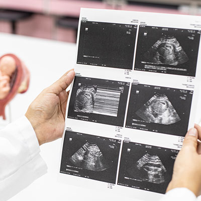 Targeted anomaly scan (Level 2 scan) in Vijayawada